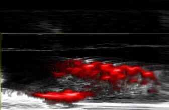 Gold Nanoparticles Promise Antibiotic-Free Bacterial Eradication