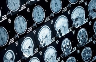 Main Research Discover No Proof of Mind Harm in Havana Syndrome Circumstances